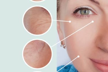 How To Get Rid Of Wrinkles And Fine Lines?