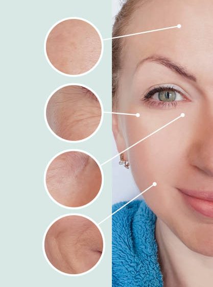 How To Get Rid Of Wrinkles And Fine Lines?